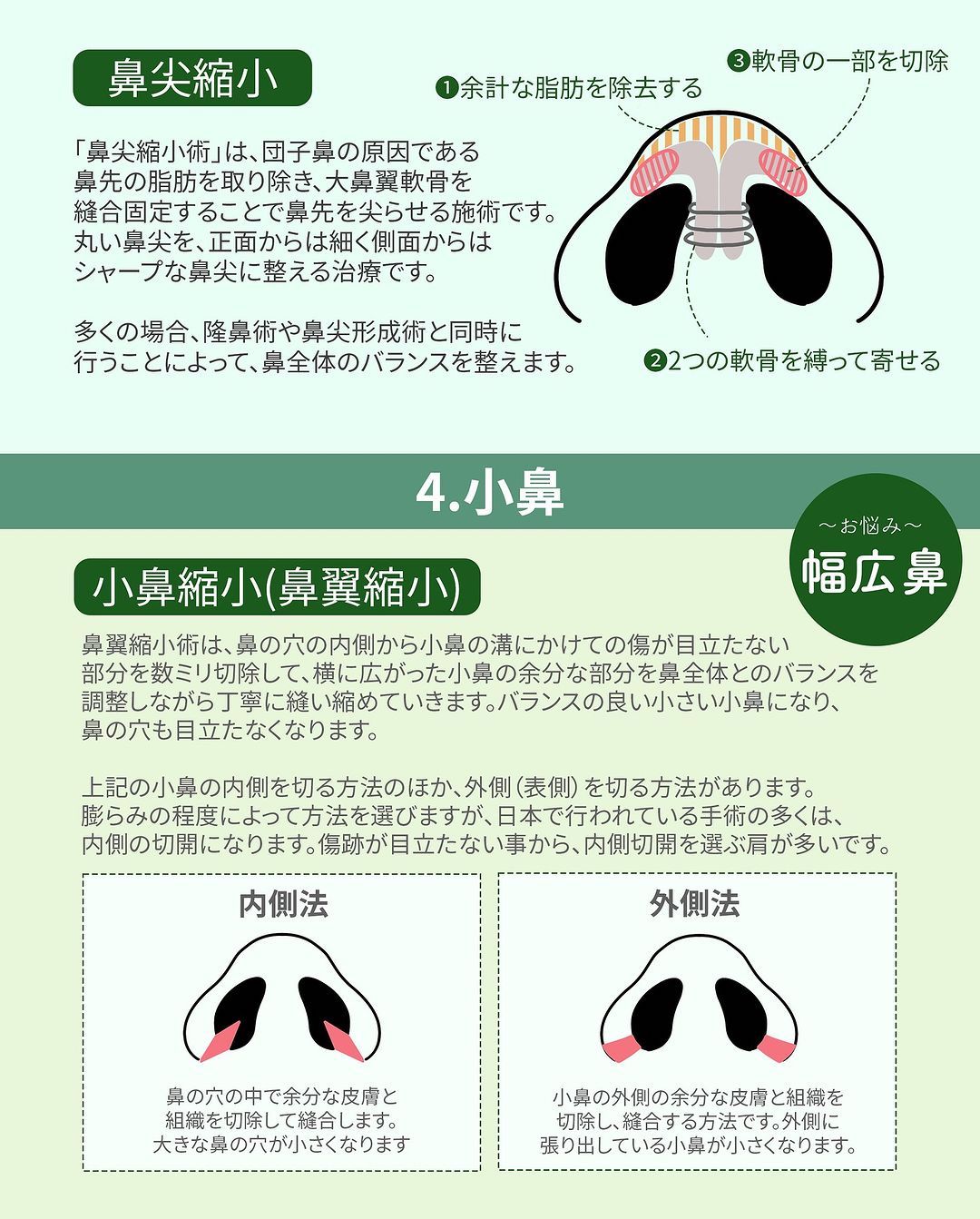 鼻翼 