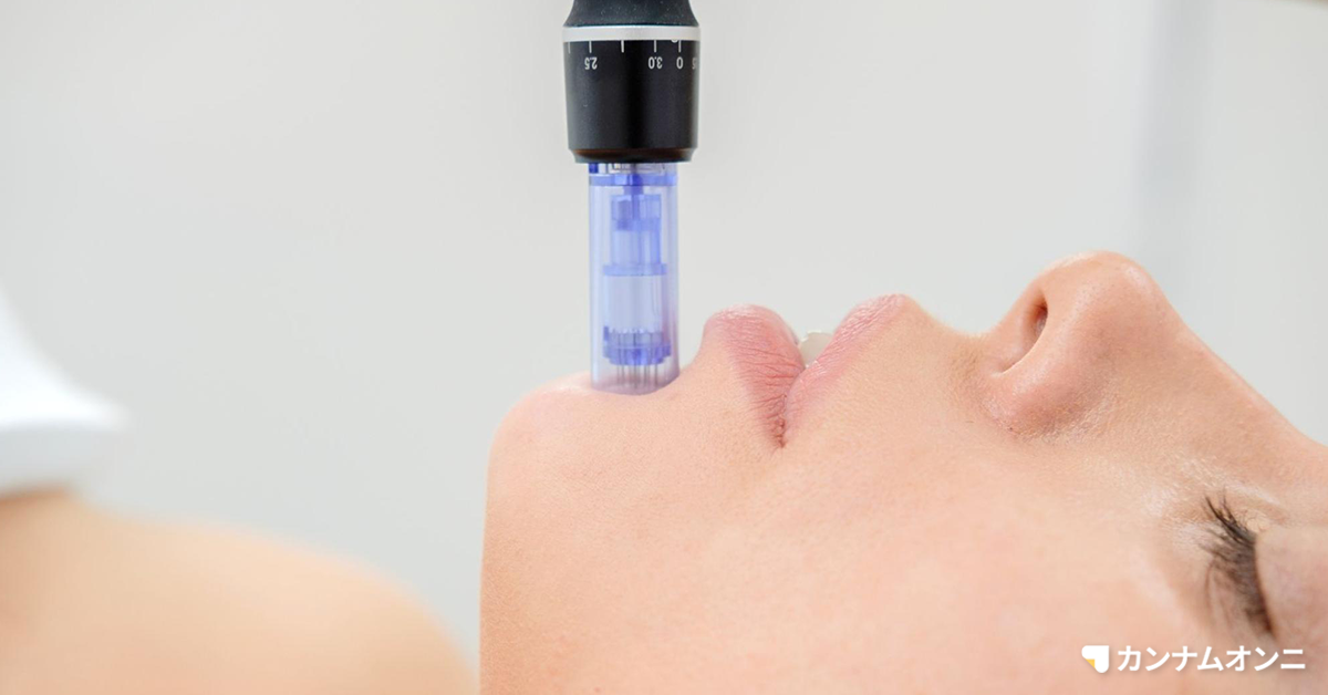 ダーマペンがいちご鼻などの毛穴悩みに効果的な理由を紹介 カンナムオンニ